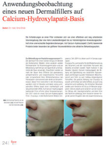 Anwendung eines neues Dermafillers auf Calcium Hydroxylapatit Basis