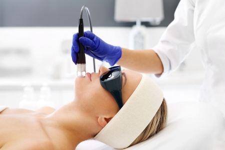 Fotona4D Behandlung mit dem Fotona4D® Laser