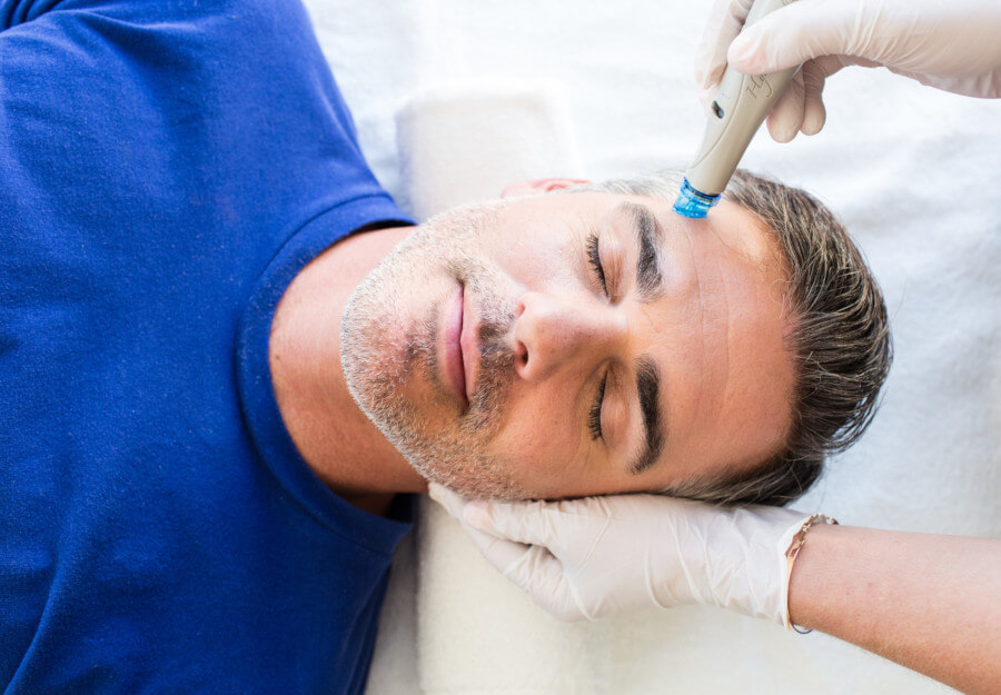 Hydrafacial Behandlung eines männlichen Patienten