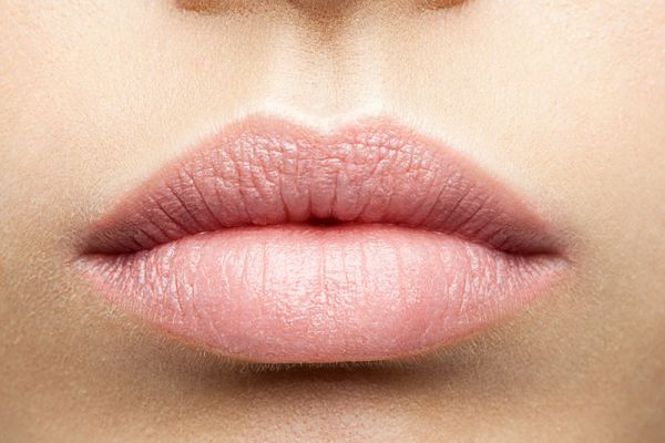 Lippen Volle Lippen nach Lippenvergrößerung