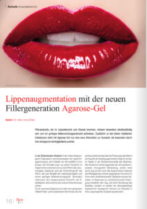 Lippenaugmentation mit der neuen Fillergeneration Agarose-Gel