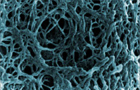 maquette-recherche02-agarosec Algeness Agarose Gelstruktur - Faltenbehandlung mit Algeness®