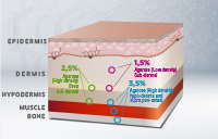 Schema Aufbau der Haut und Injektionstiefe der Filler
