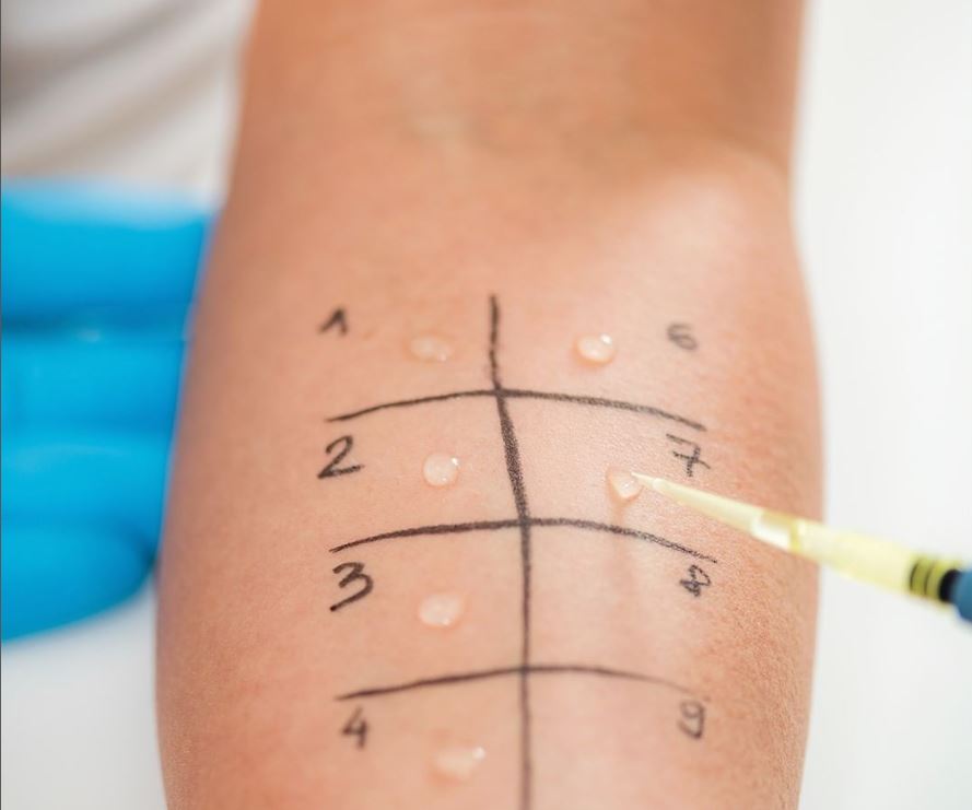 allergietest Patient beim Allergietest in Frankfurt