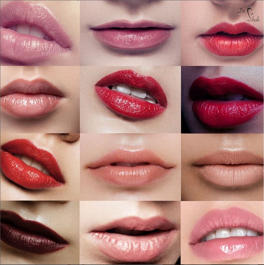 lippen-aufspritzen schöne Lippen nach Lippenvergrößerung